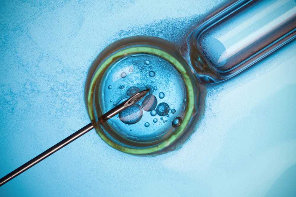 AMH and Fertility: The Pro's and Con's of Low AMH and IVF